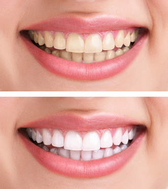A woman who received cosmetic dentistry services in Murray Hill, NY